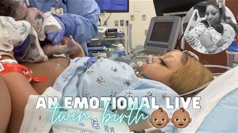 free pregnant webcam|Twin birth video: Watch live delivery of twins 